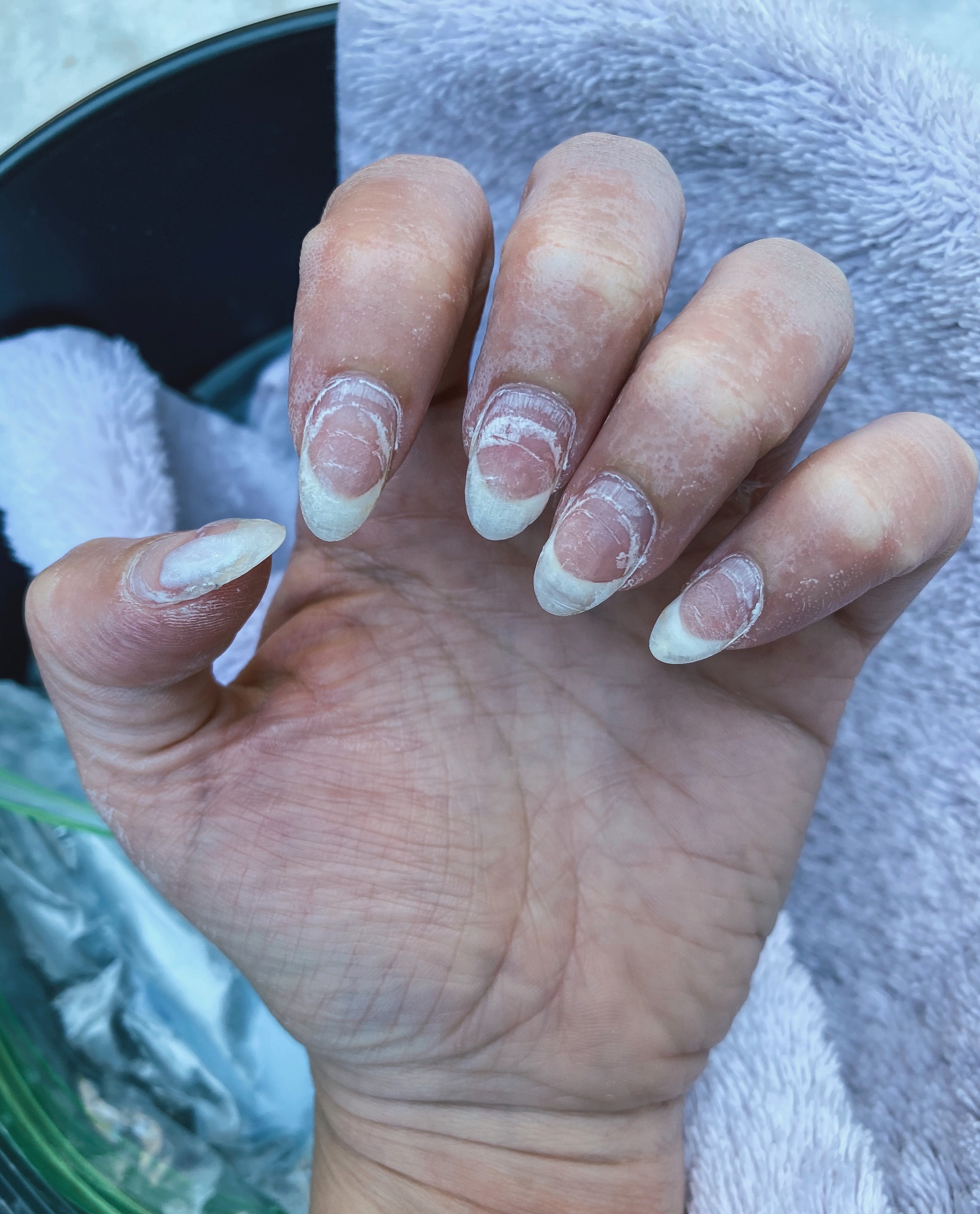 Nails after a soak in 100% acetone, Remove Dip Nails at Home